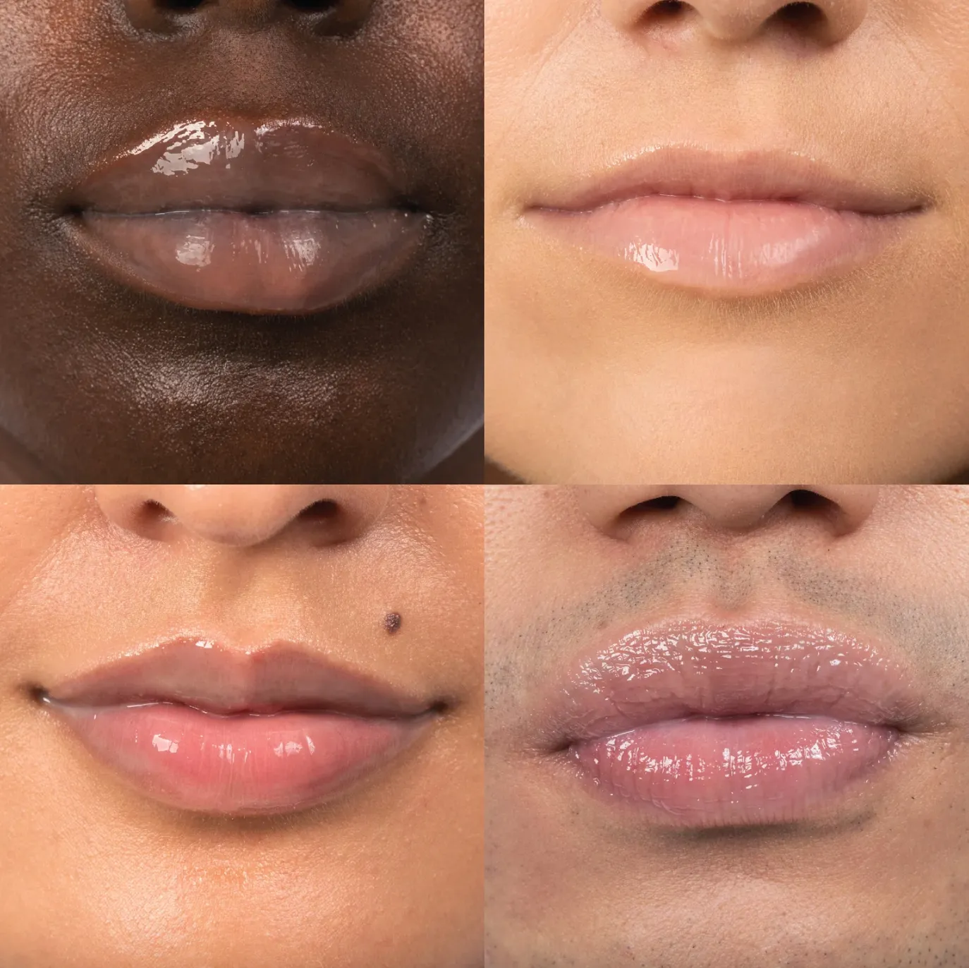 hydration lip treatment